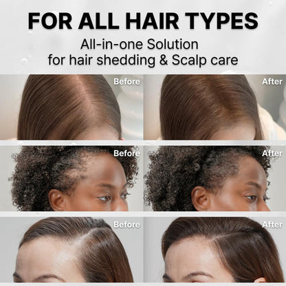 Scalp Serum with Massage Comb for Hair Growth